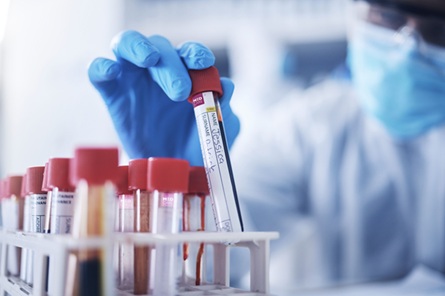 Medcare unveils AI technology to spot heart disease before it even begins